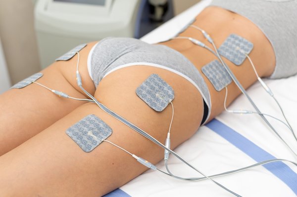 L'électrostimulation à Montpellier : un atout pour votre santé